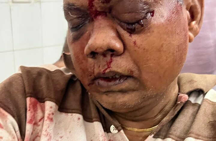 कांग्रेस नेता श्याम कश्यप पर जानलेवा हमला में इलाज के दौरान निकाली गई एक आंख, आरोपियों की अब तक नहीं हुई गिरफ्तारी