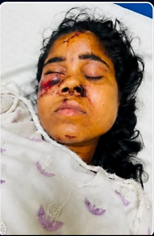 रेल हादसे में घायल युवती के परिजनों की तलाश, सिम्स में चल रहा उपचार