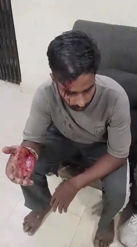 बिलासपुर में साइकिल दुकान संचालक पर बेसबॉल बैट से हमला, भतीजे से मोबाइल मांगने को लेकर हुआ विवाद; सिर में आई चोट