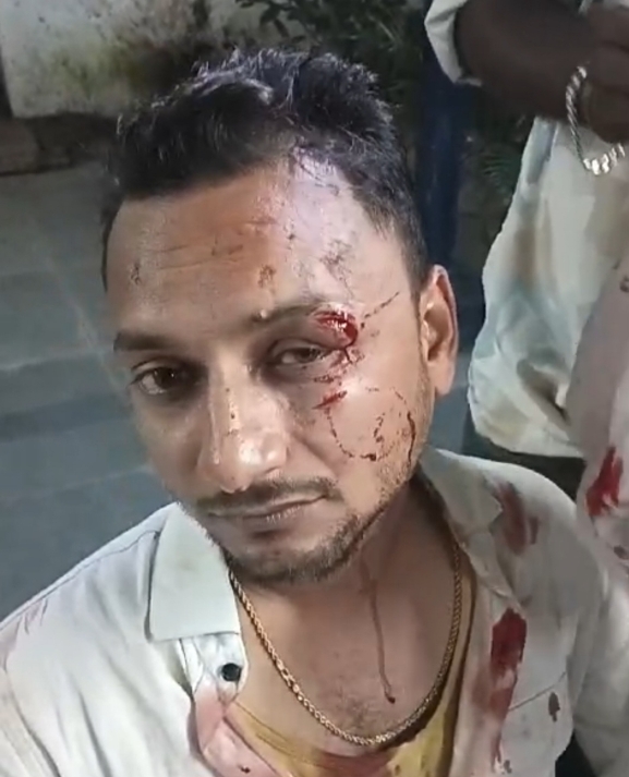 तंत्रा बार में बाउंसर और युवकों के बीच हुई मारपीट में घायल हुआ युवक, बार-बार की घटनाओं से सबक लेते हुए एसपी ने सभी क्लब और बार में लेडी बाउंसर रखने के दिए निर्देश