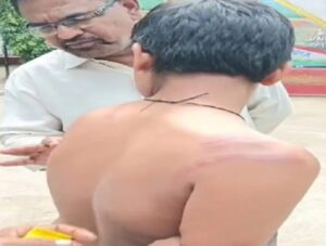 नोट्स नहीं बनाने के कारण छात्र की बेरहमी से पिटाई करने वाला संस्कृत टीचर हुआ सस्पेंड, अखिल भारतीय विद्यार्थी परिषद ने भी कराया विरोध दर्ज