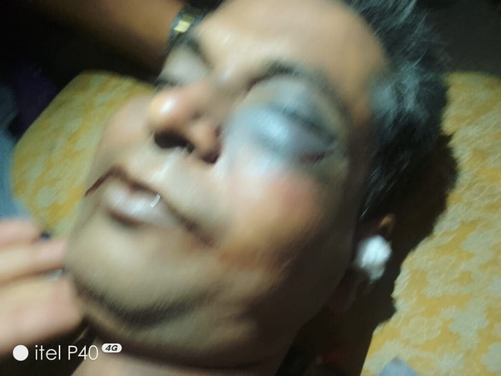 सिलतरा में व्यापारी की मौत के मामले में शॉर्ट पीएम से भारी उलट फेर, पुलिस ने कार्डियक अरेस्ट से मौत होने की बात कही, चुनावी रंजिश से हत्या की आशंकाओं को किया खारिज