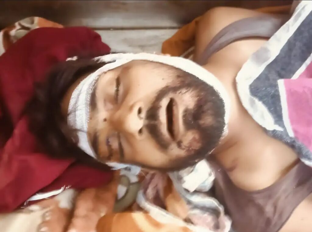 जमीन के बंटवारे के विवाद में भाइयों के बीच खूनी संघर्ष, एक की मौत, गर्भवती महिला समेत कई घायल