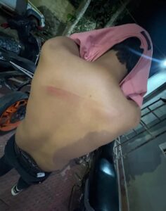 पहले तो 150 रुपए की जगह ₹100 का डाला पेट्रोल और फिर शिकायत करने पर ग्राहक की कर दी जमकर पिटाई , जानिए बिलासपुर के किस पेट्रोल पंप में हुई यह घटना