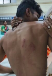 कथित रूप से रंगदारी करने का आरोप लगाकर बदमाशों ने कर दी युवक की बेरहमी से पिटाई