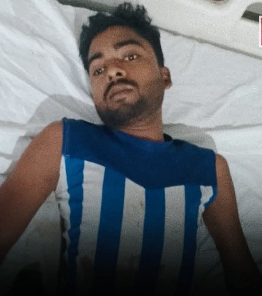 ना रहेगा बांस न बजेगी बांसुरी, बहन को दिया धोखा तो भाभी ने सोते हुए देवर का काटा प्राइवेट पार्ट