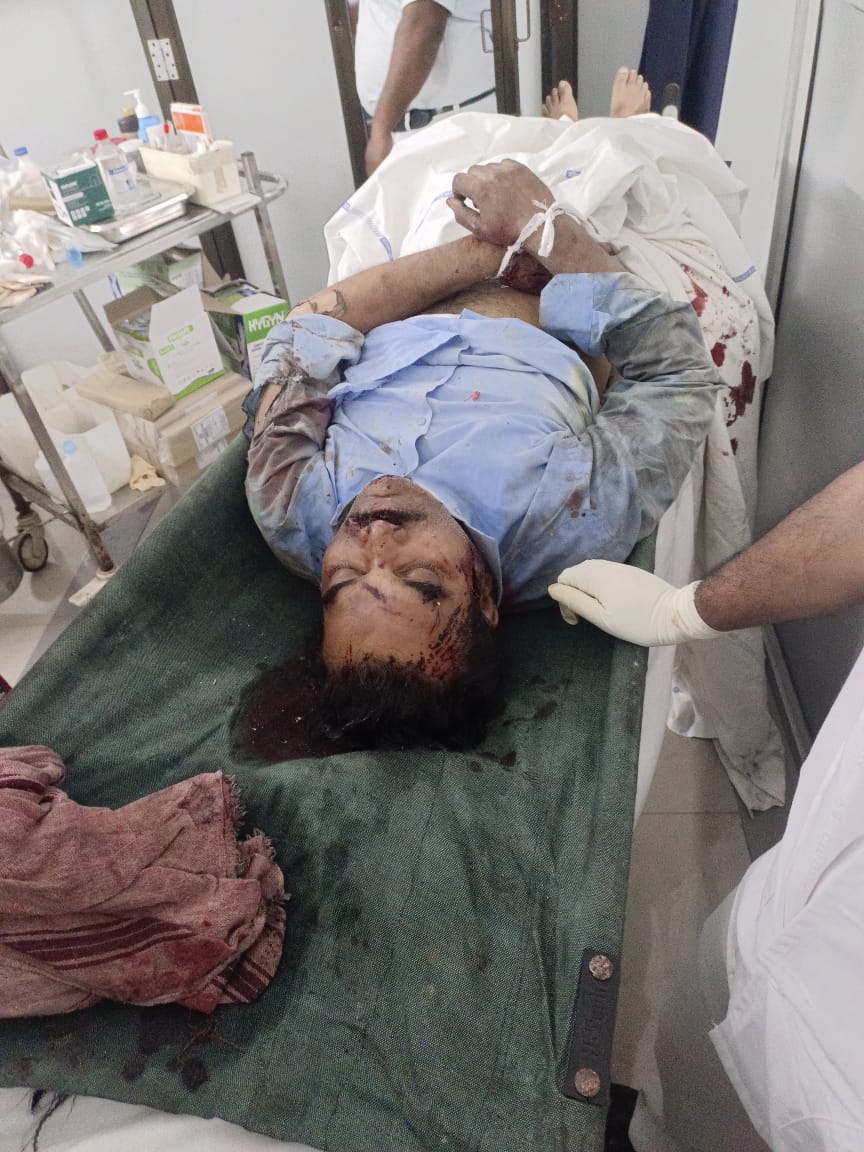 मुख्यमंत्री श्री विष्णुदेव साय ने बिलासपुर के पास हुई ट्रेन दुर्घटना पर गहरा दुःख व्यक्त किया, दिवंगतों के परिजनों को ₹5 लाख एवं घायलों को ₹50 हज़ार की आर्थिक सहायता देने की घोषणा