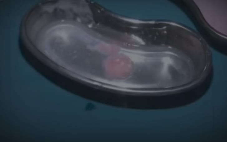 देवपुरी स्वास्थ्य केंद्र में प्रसूता को मिला संदिग्ध दवा का सिरप, बोतल में मिला मांस जैसा टुकड़ास्वास्थ्य व्यवस्थाओं पर उठे गंभीर सवाल, सैंपल लैब भेजने की तैयारी