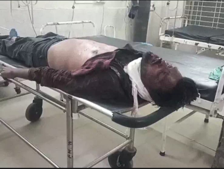 प्रेमिका ने वीडियो कॉल पर मांगी मदद, लोकेशन से पहुंची पुलिस,शादी से इनकार पर प्रेमी ने पहले युवती का गला रेता, फिर खुद की जान ली, शादीशुदा युवक की मौत, युवती गंभीर—सिम्स में इलाज जारी