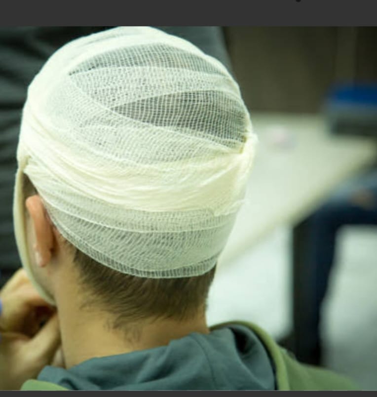 खुले नाले में गिरा 12 वर्षीय बालक, आठ टांके लगे; कालोनीवासियों ने उठाई स्लैब डालने की मांग