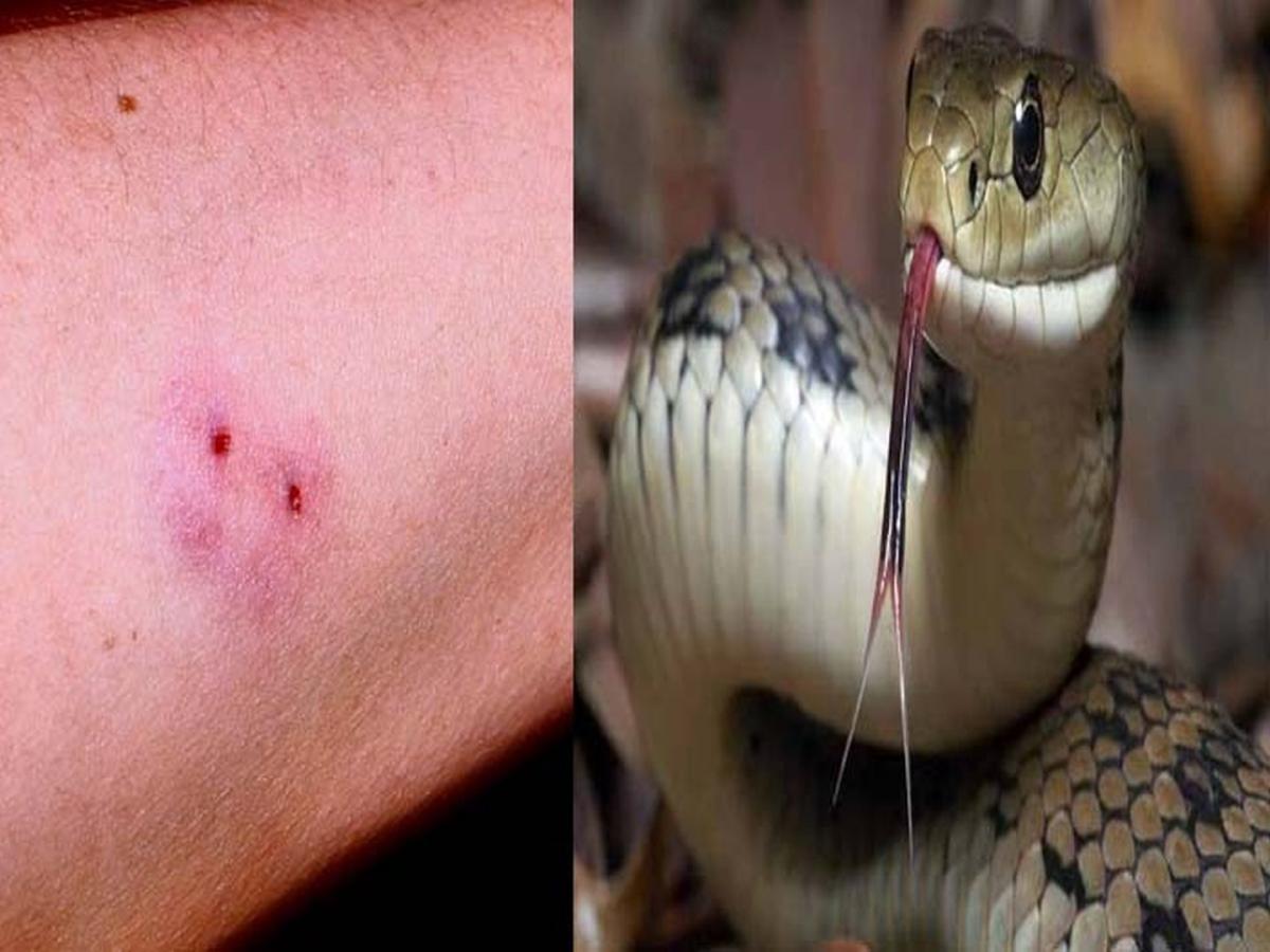 लकवा से हुई मौत को बनाया सर्पदंश, फर्जी दस्तावेजों से हड़पे 4 लाख, महिला समेत सहयोगियों पर धोखाधड़ी और कूटरचना का केस दर्ज, पुराने मामलों की भी होगी जांच