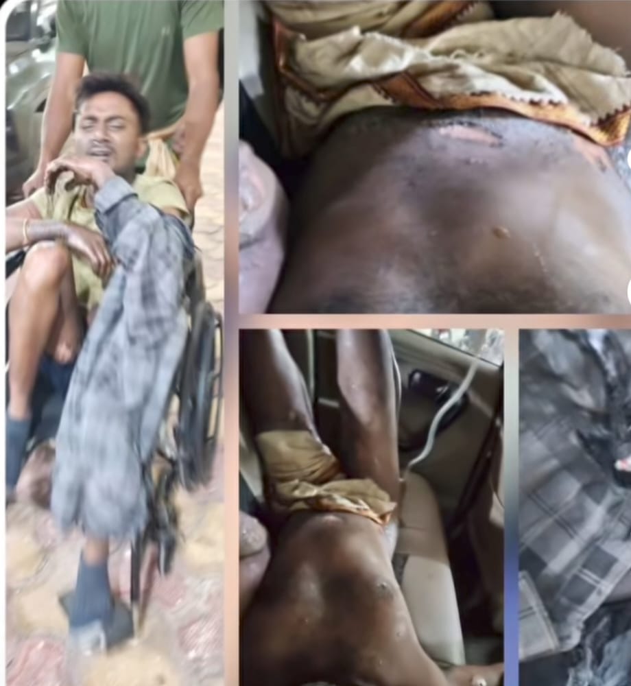 नोवा स्पंज आयरन प्लांट में हादसा, खौलते लोहे से 4 कर्मचारी झुलसे