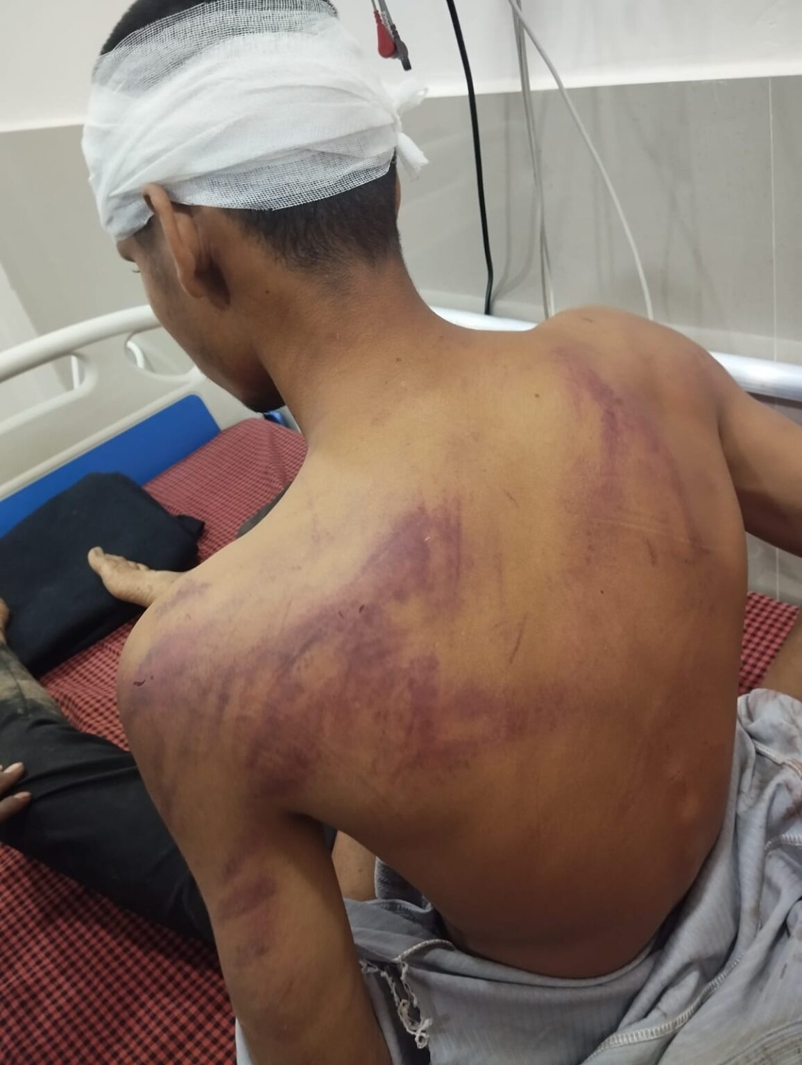 विवाद के बाद स्थानीय युवकों ने बारातियों को दौड़ा-दौड़ा कर पीटा