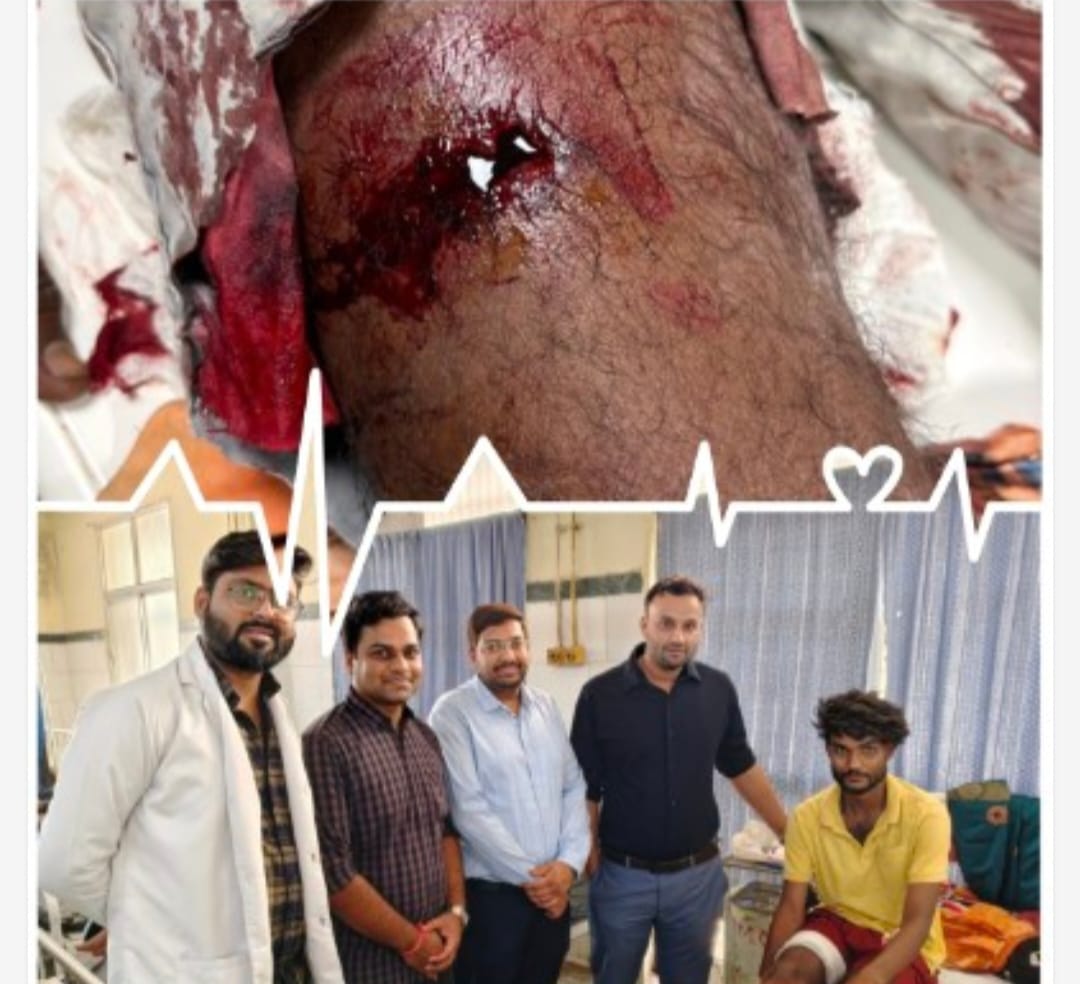सिम्स के चिकित्सकों ने एक बार फिर किया कमाल , जांघ में फंसी गोली निकाल कर बचाई मरीज की जान