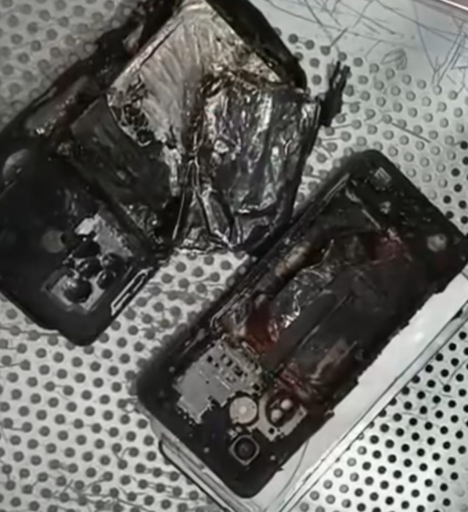 जेब में मौजूद मोबाइल के फटने से युवक हुआ घायल