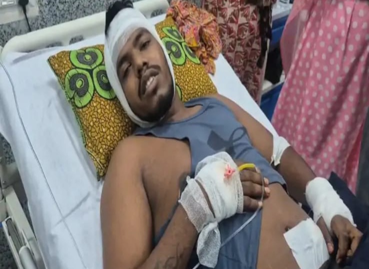 मामूली विवाद में युवक पर चाकू से जानलेवा हमला, हत्या के प्रयास का मामला दर्ज