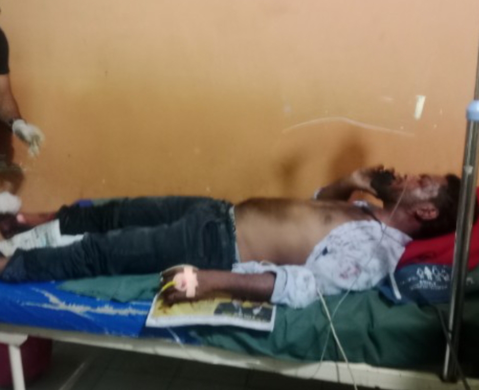 एसी कंप्रेसर में हुए धमाके से दो भाई गंभीर रूप से घायल