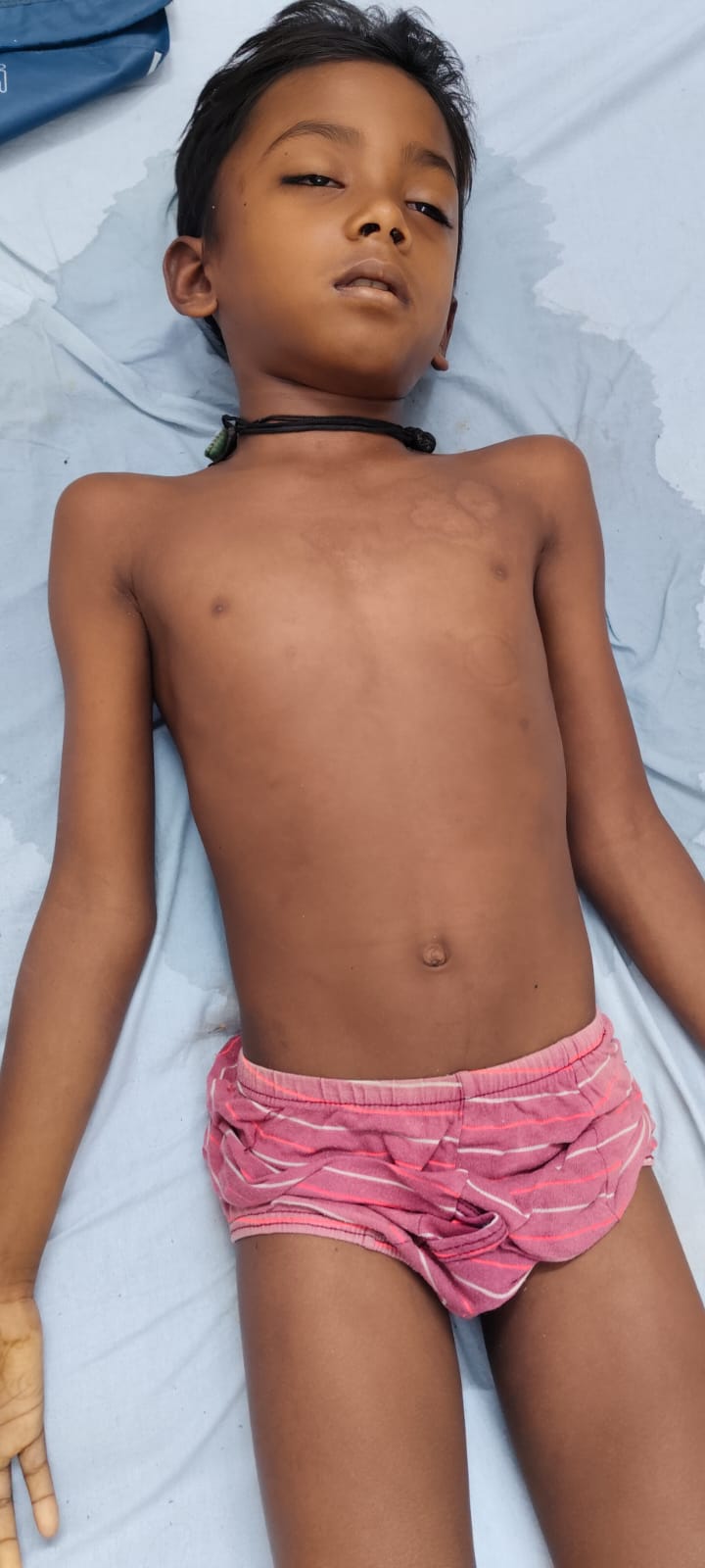 तालाब में नहाने के दौरान हादसा, 9 वर्षीय बालक की डूबने से मौत, मां ने बहन को बचाया