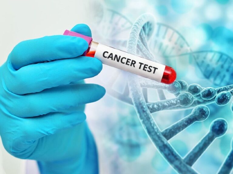 cancer-test_1617098282.jpg