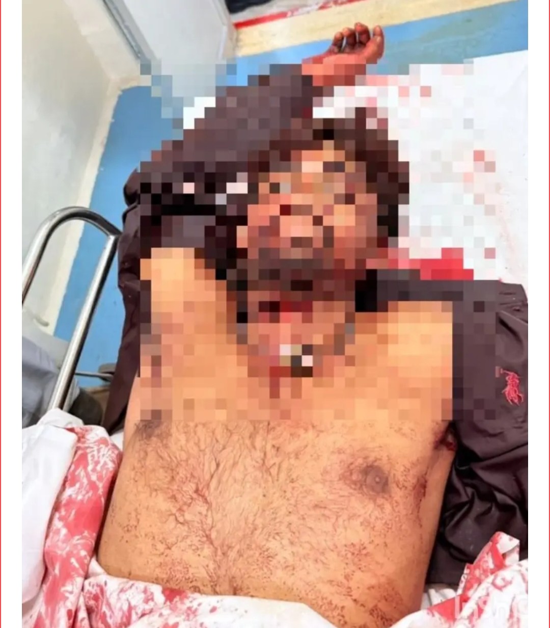 बिलासपुर में अपने छोटे भाई को बचाने पहुंचे युवक की जघन्य हत्या