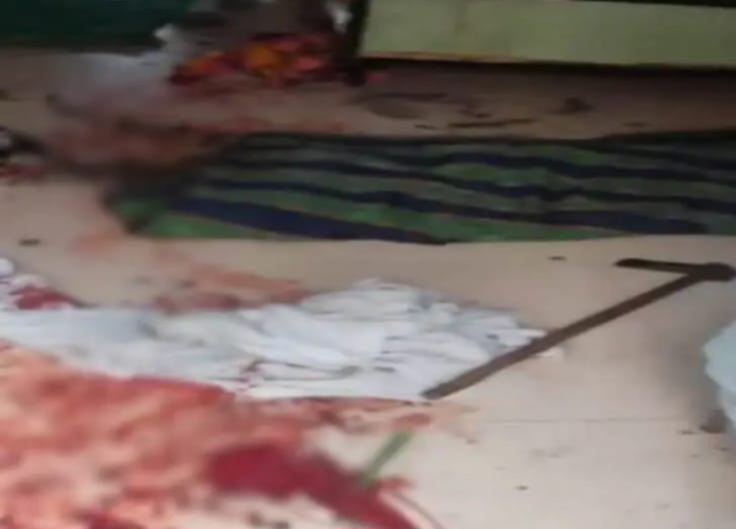 मोटर पंप चालू करने के विवाद में ऑटो चालक पर कुल्हाड़ी से हमला, सिम्स में भर्ती