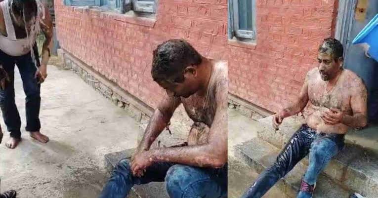 रूटीन मेंटेनेंस के दौरान मल्टी सुपर स्पेशलिटी अस्पताल के ट्रांसफार्मर में धमाका, दो कर्मचारी झुलसे