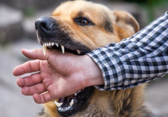 dog-bite-16942558373x2.jpg
