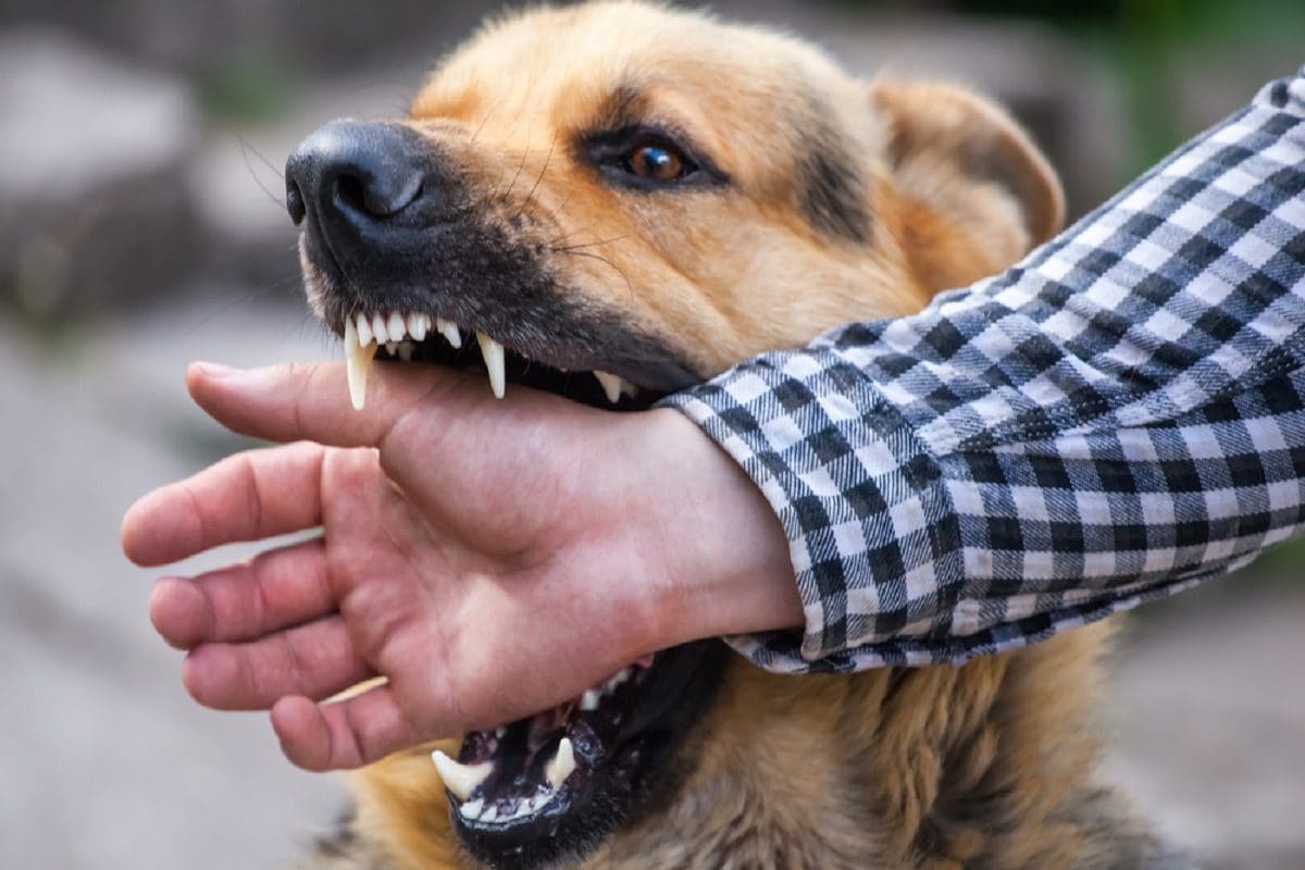 dog-bite-16942558373x2.jpg